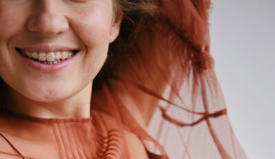 Immer mehr Erwachsene entscheiden sich für eine Zahnspange