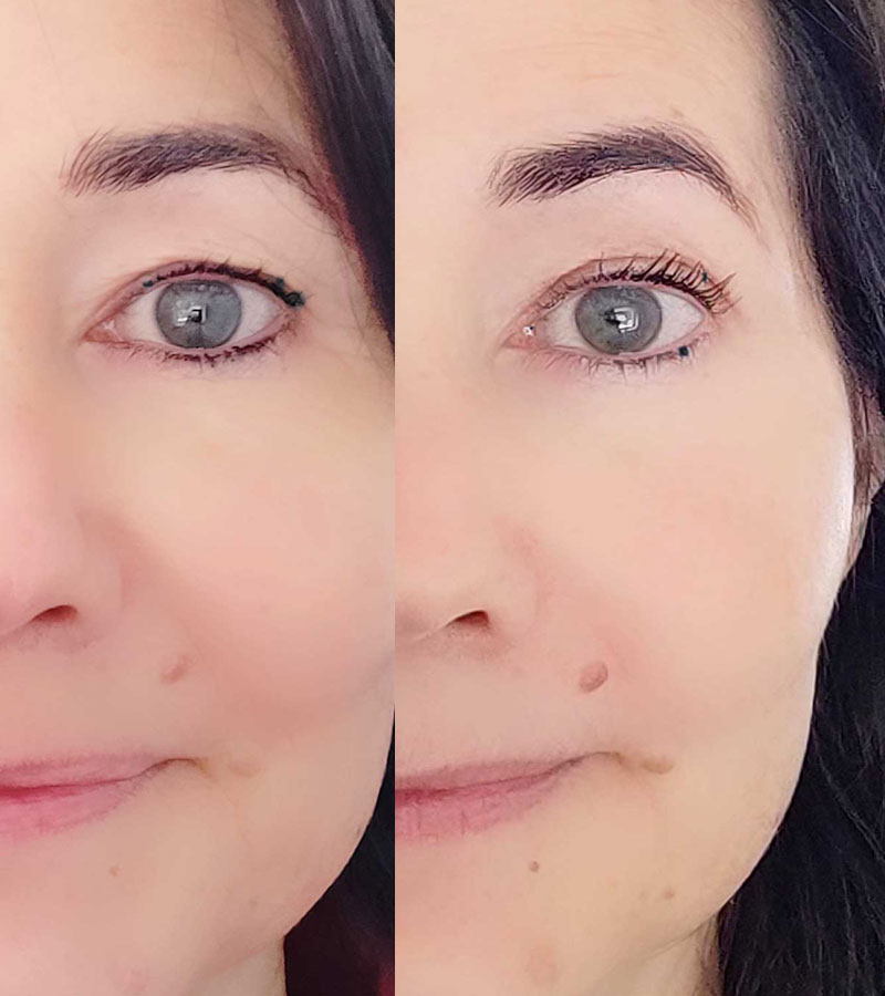 Mein Schlupflid einmal normal und einmal mit Lifting Stripe