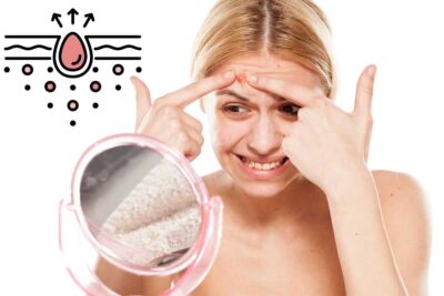 Pickel und Hautunreinheiten loswerden