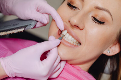 Veneers 7 Mythen im Faktencheck